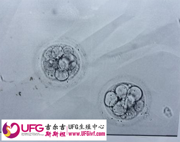 做第三代试管胚胎筛查后一般还剩几个能用