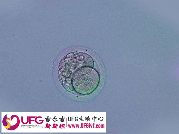 三代试管对于胚胎质量要求比较高