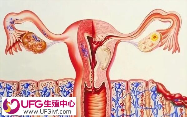 子宫内膜厚度低于8mm属于内膜薄