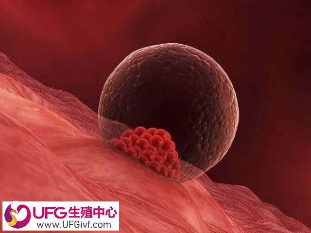 试管移植后可以穿着舒适的衣服